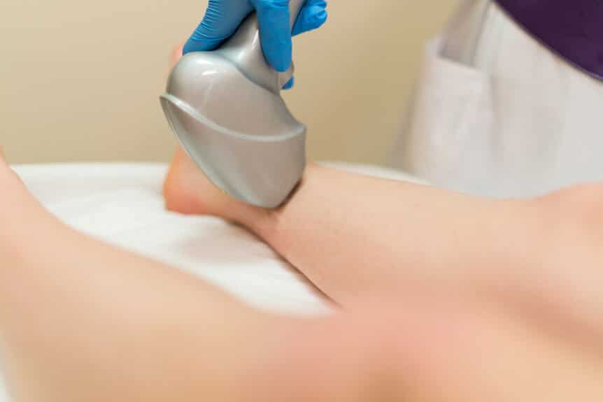 Non-Surgical Laser Treatment for Varicose Veins: